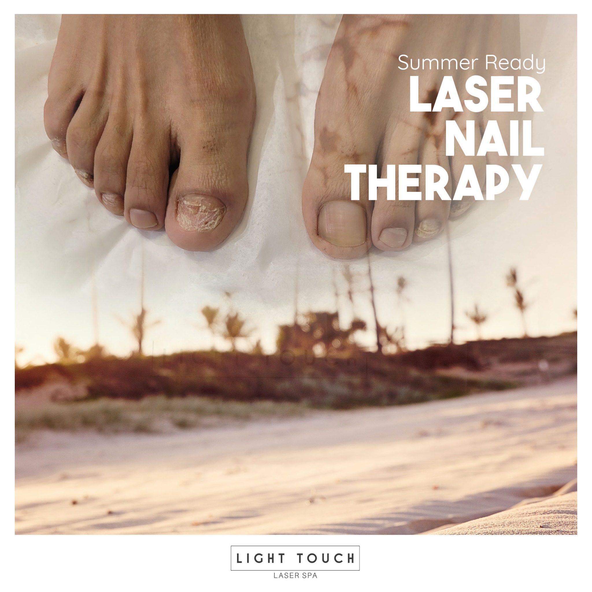 Light Touch Laser Spa - Фото 5