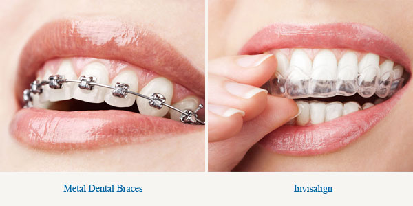 My Smiles Orthodontics - Фото 2
