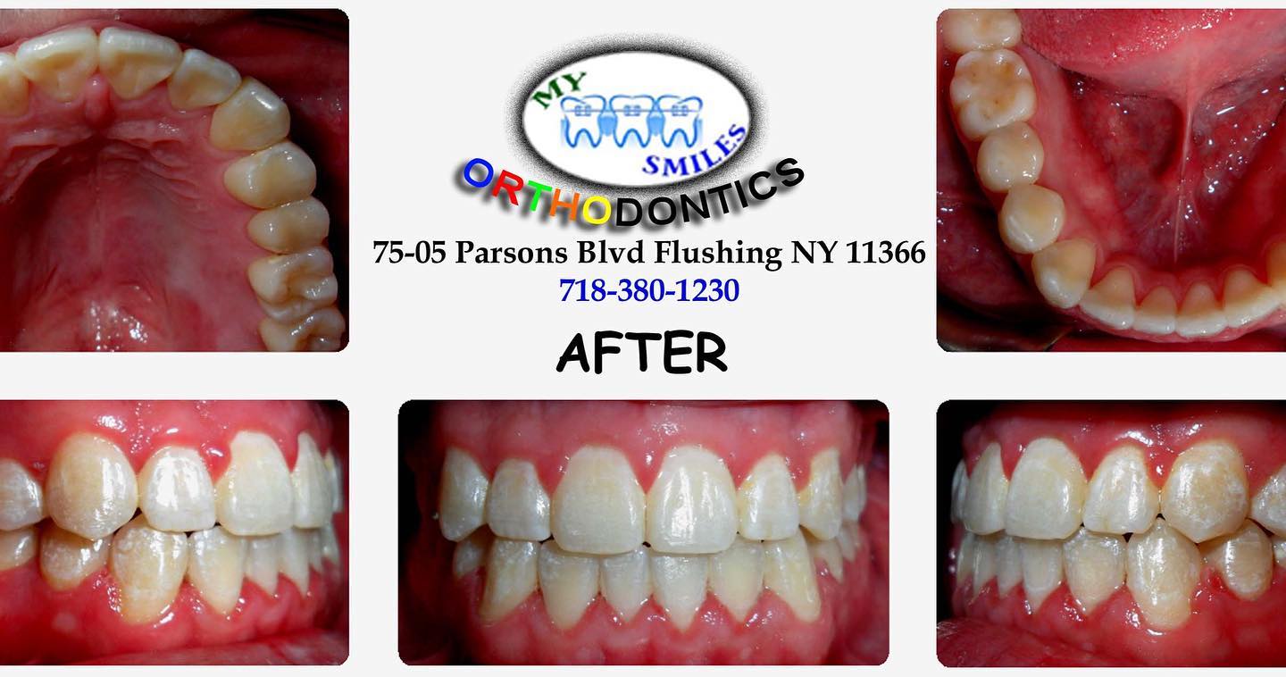My Smiles Orthodontics - Фото 3