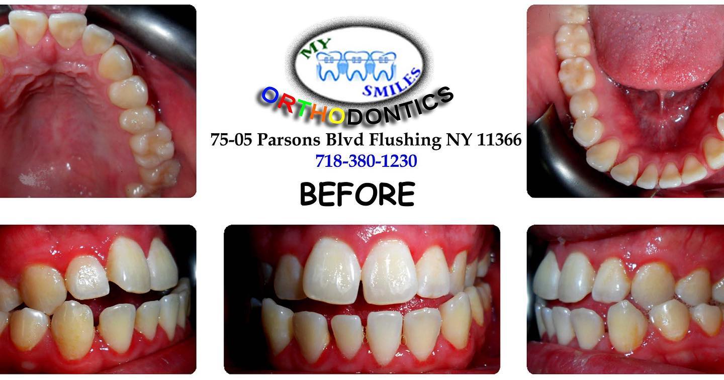 My Smiles Orthodontics - Фото 4