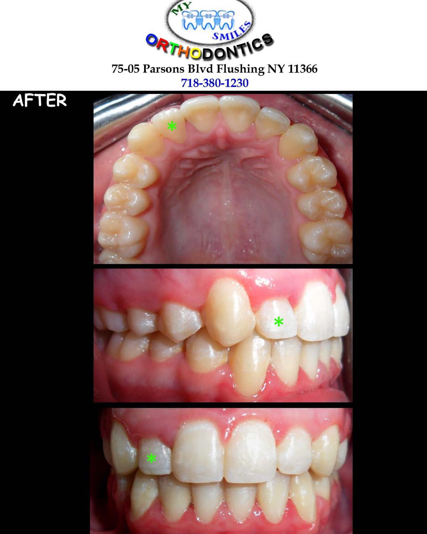 My Smiles Orthodontics - Фото 5