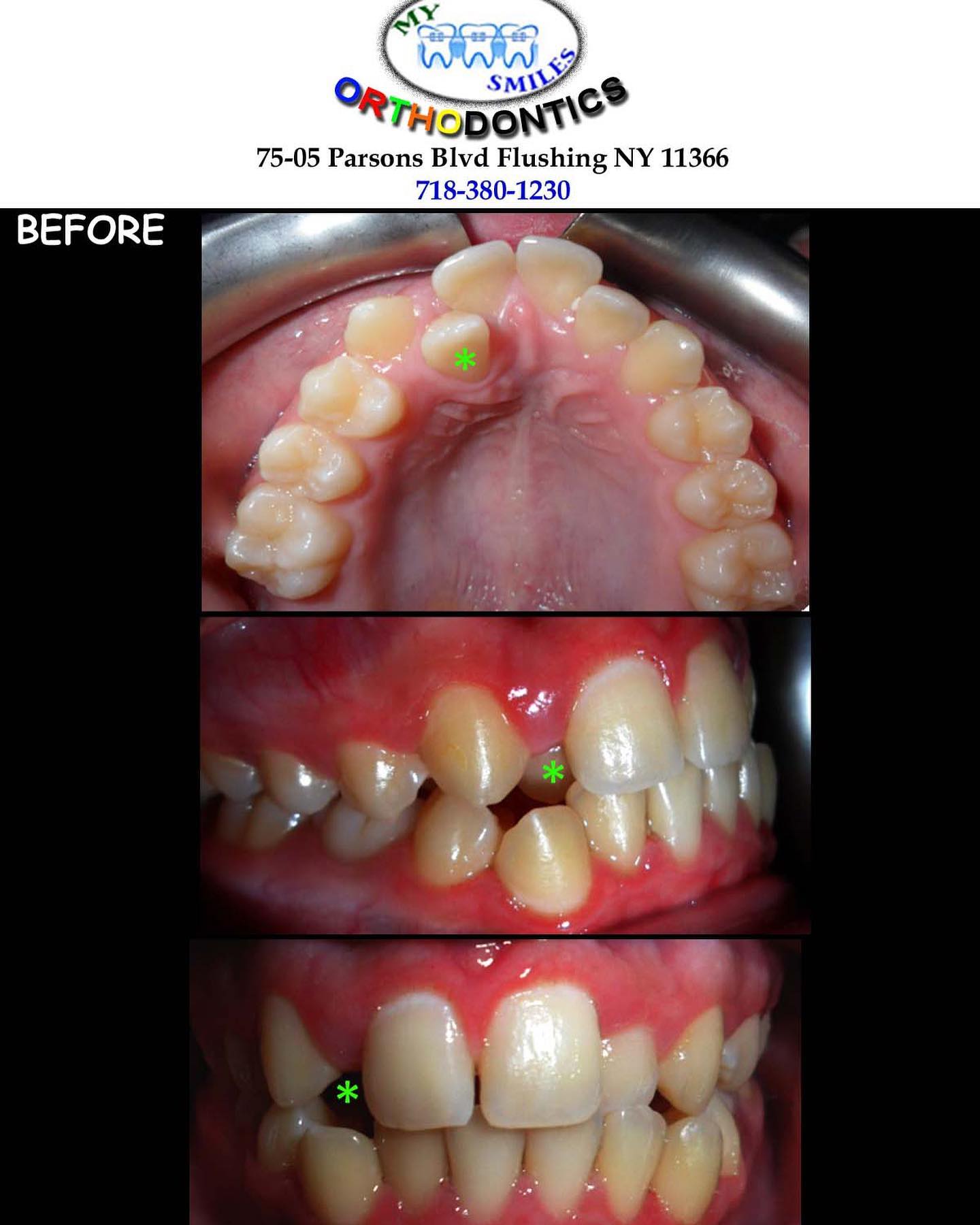 My Smiles Orthodontics - Фото 6