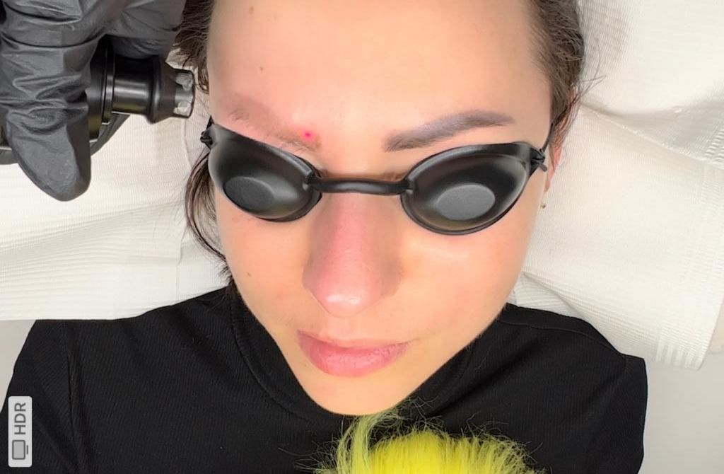 Laser Tattoo Removal & PMU NYC - Фото 3