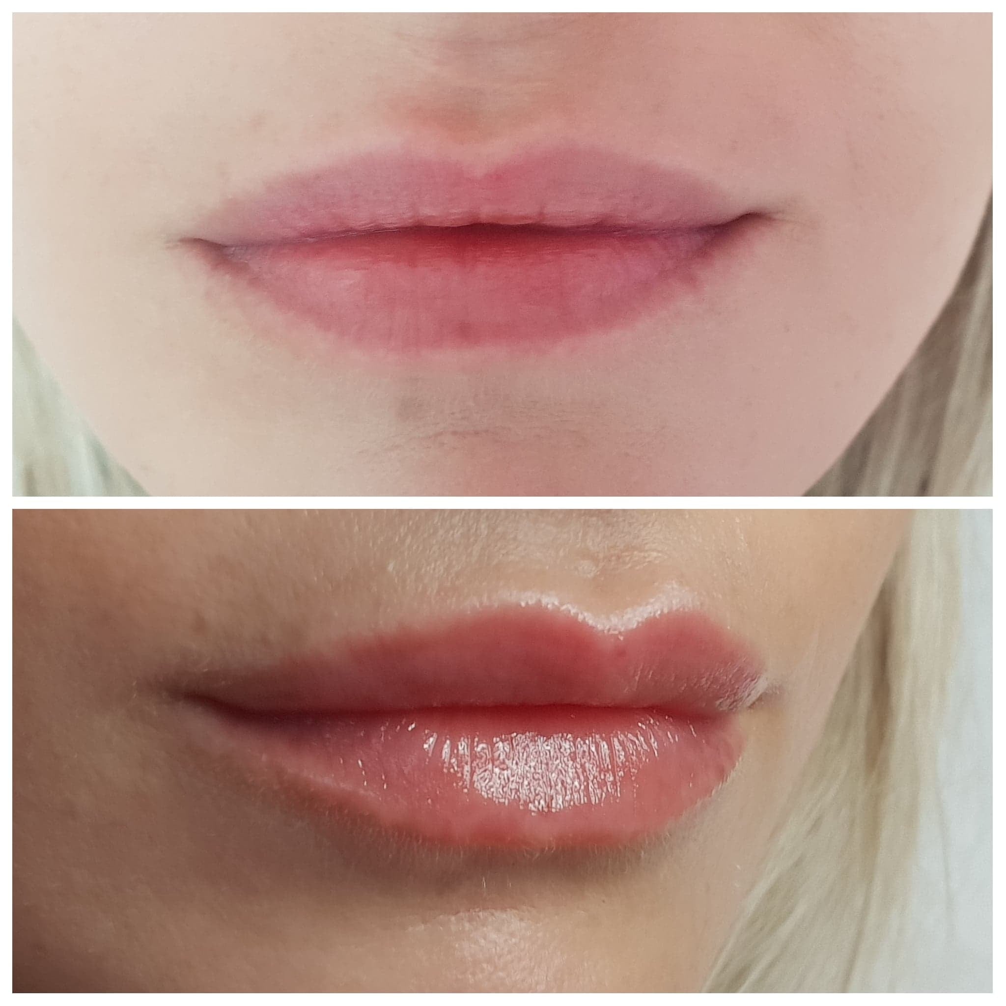 Aesthetic Laser Beauty Clinic - Zdjęcie 2