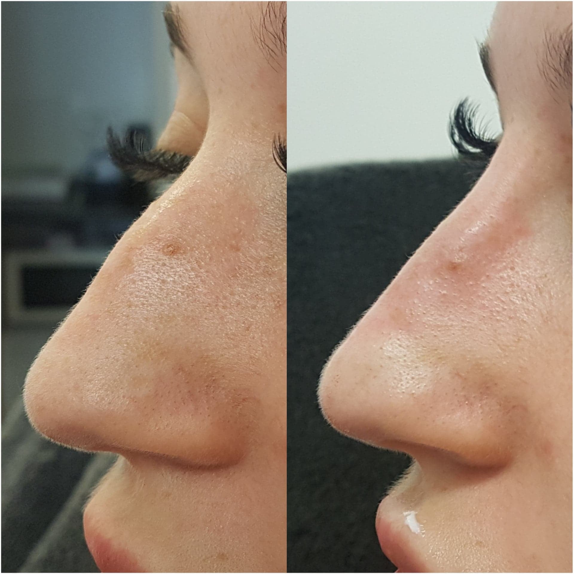 Aesthetic Laser Beauty Clinic - Zdjęcie 4
