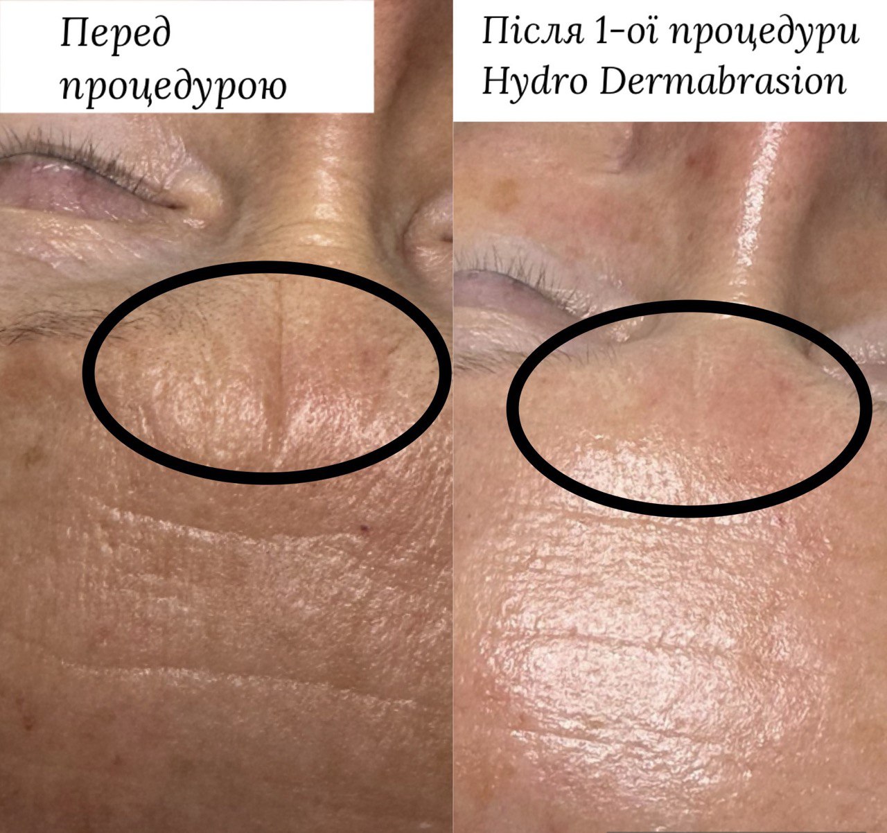 Вікторія - Ліцензійний Естетик - Фотографія 11