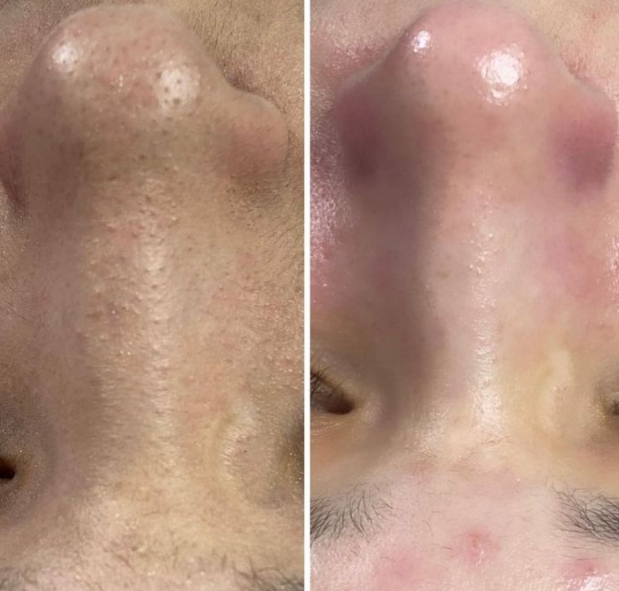 Yaroslava, Cosmetology | Eyebrows | Sugaring - Фото 3