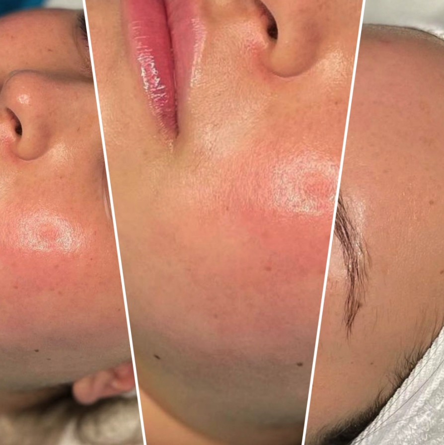 Esthetician Acne Сontrol Specialist NYC - Фото 3