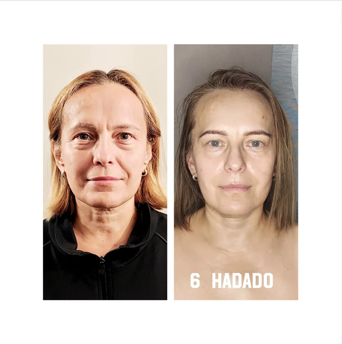 Magdalena Domańska/ Glam Skin - Zdjęcie 2