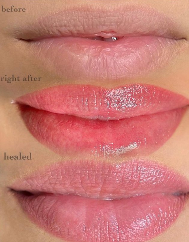 Vera, Professional Permanent Makeup - Фото 5