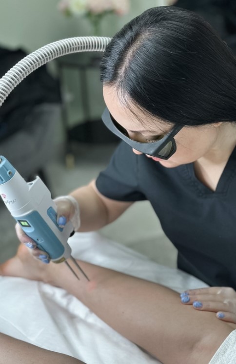 Laser Hair Removal | Staten Island - Фото 2