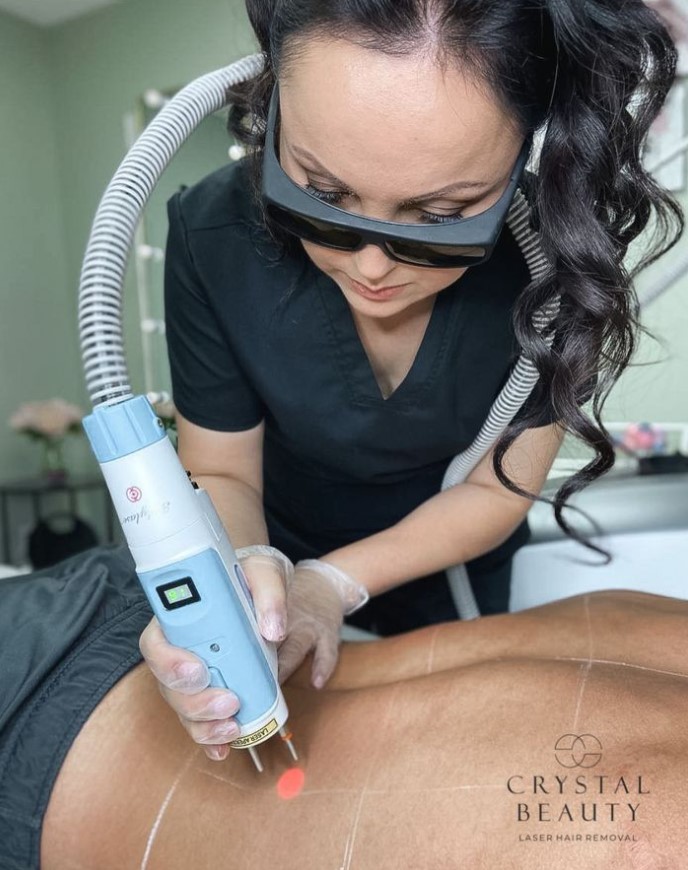 Laser Hair Removal | Staten Island - Фото 4