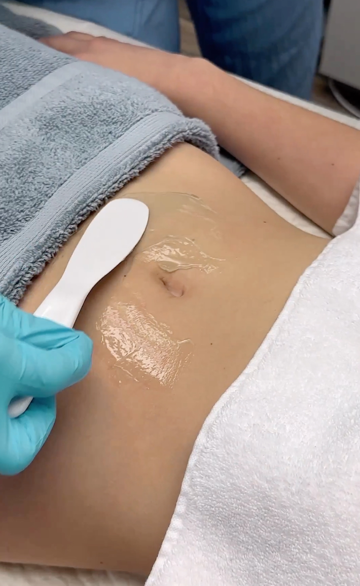 NEW U BODY Contouring - Lipomassage - Фото 4