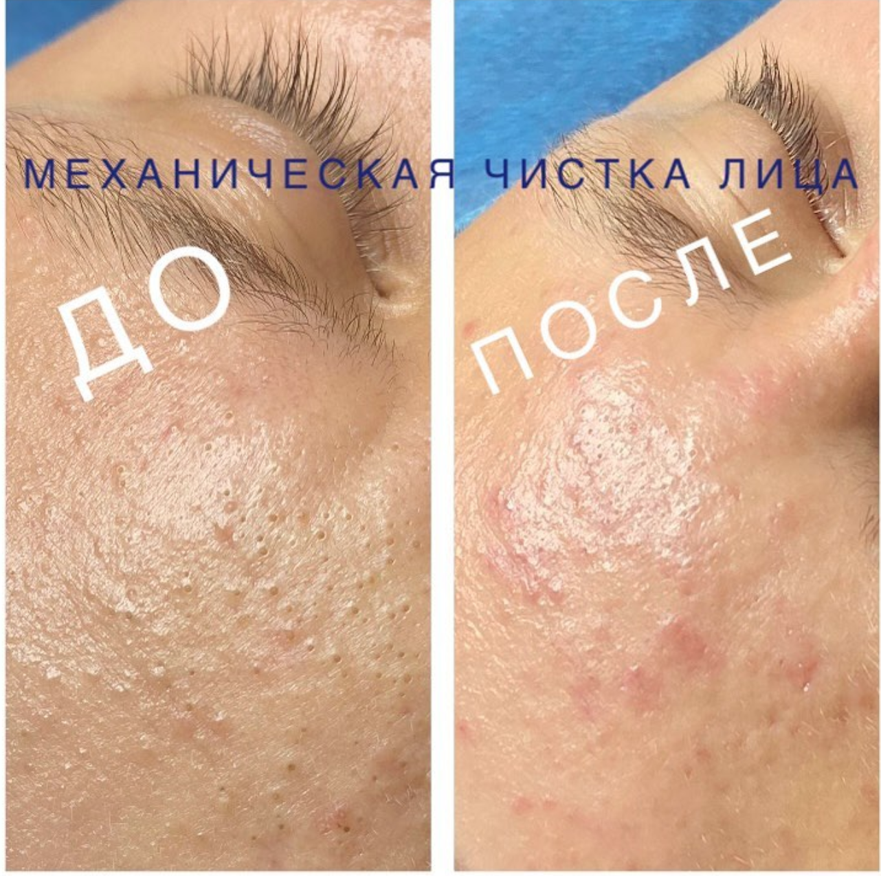 Позаботься о своей коже с профессиональным косметологом! - Фото 3