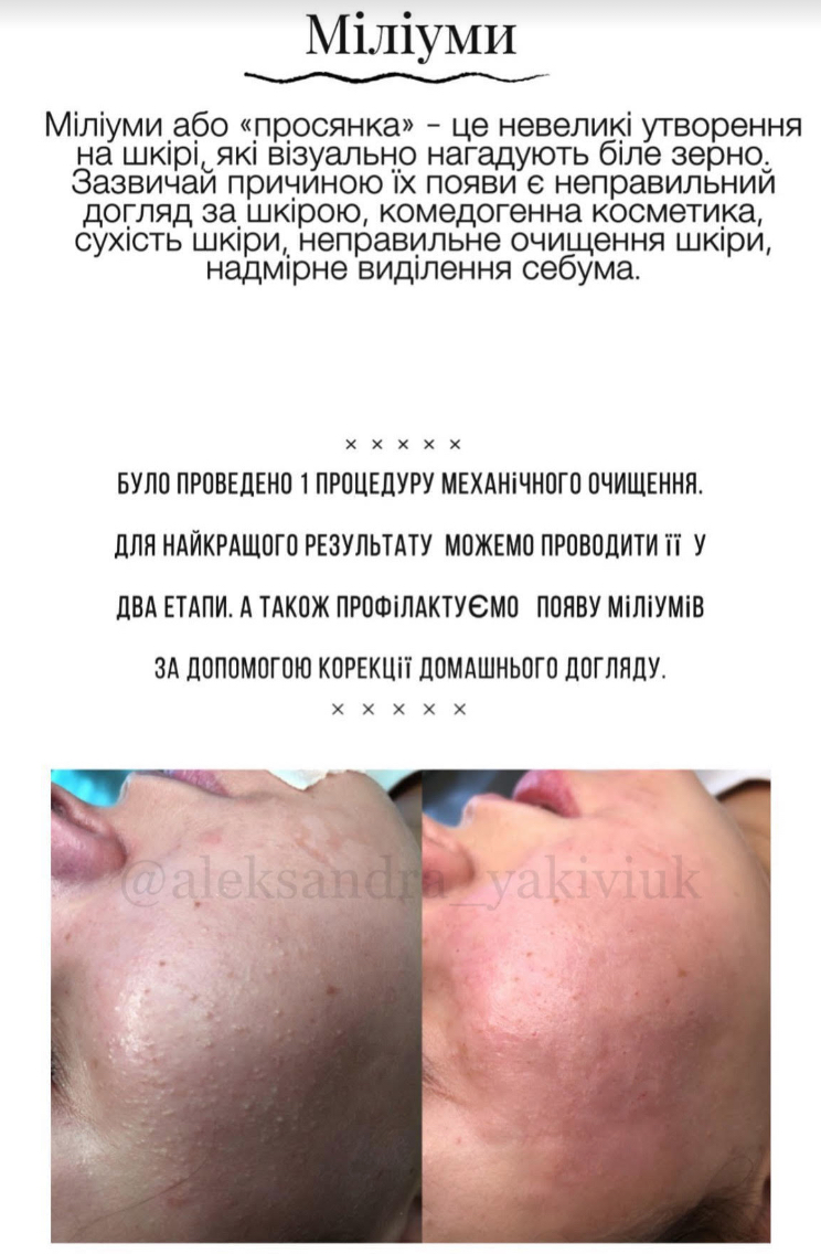 Kосметолог з Медичною Освітою/ Олександра - Фотографія 4
