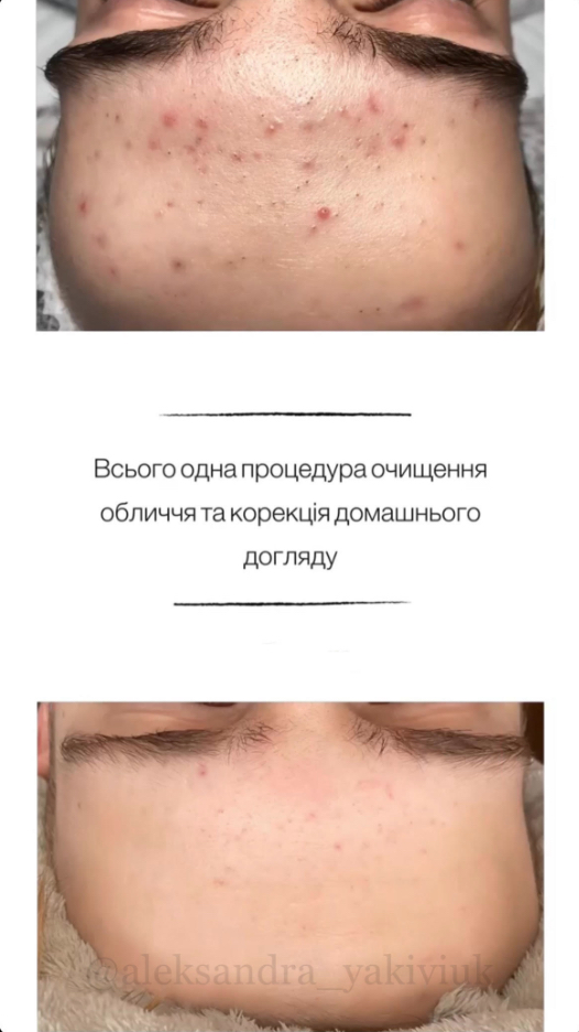 Kосметолог з Медичною Освітою/ Олександра - Фотографія 5
