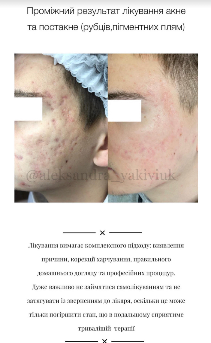 Kосметолог з Медичною Освітою/ Олександра - Фотографія 11
