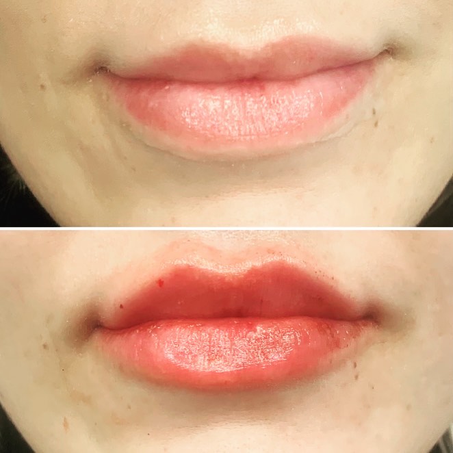 Art of Injections | Medica Spa - Фото 2