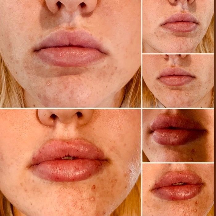 Art of Injections | Medica Spa - Фото 3