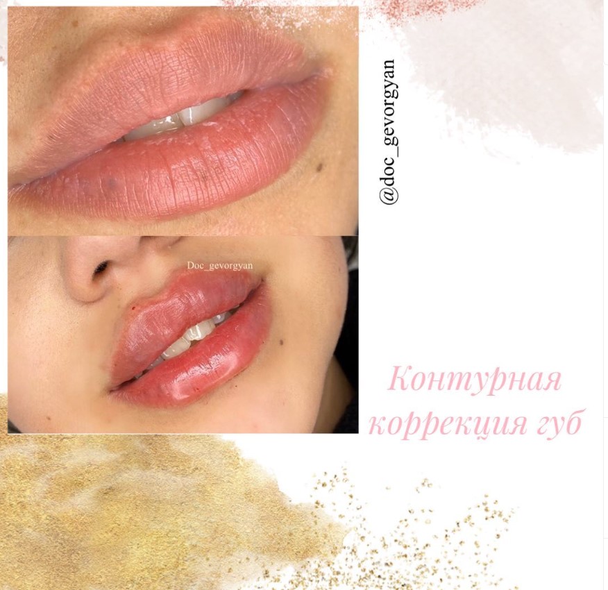 Lilit, Cosmetologist - Фото 2