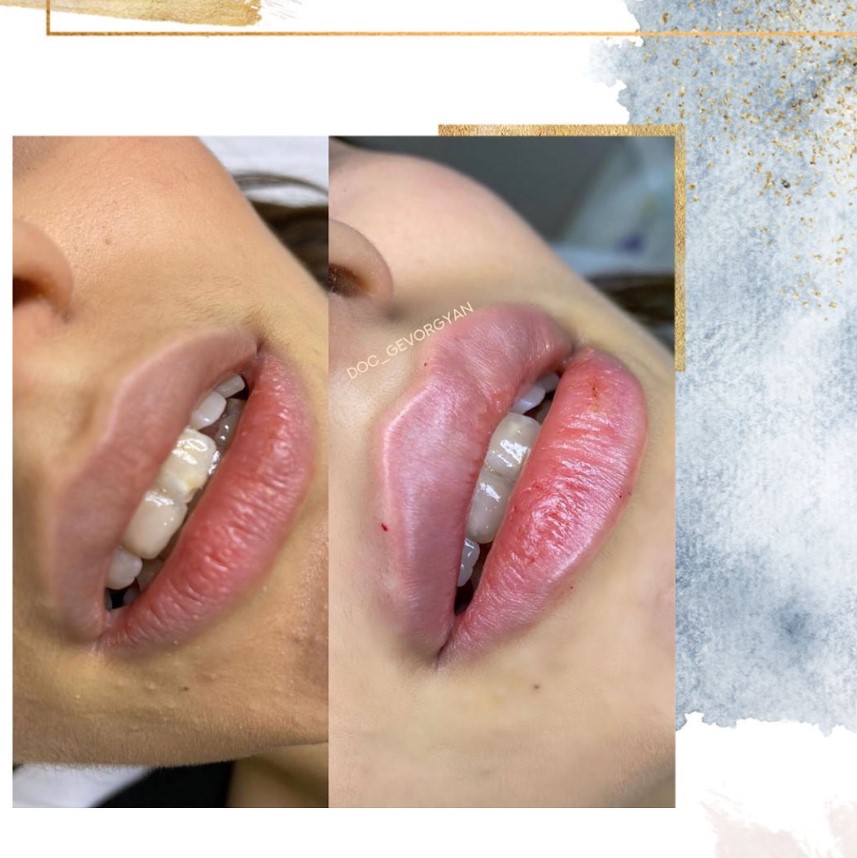 Lilit, Cosmetologist - Фото 3