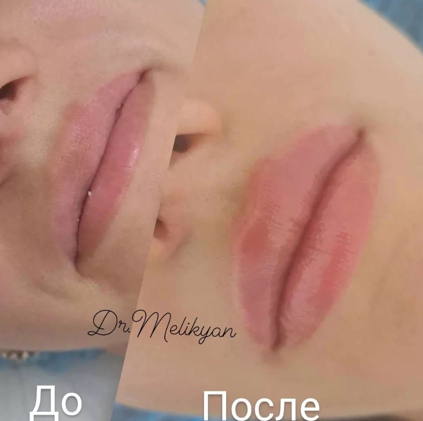 Лилия, Косметолог - Фото 3