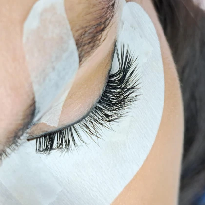 nna-poslugi-leshmeykera-1-photo