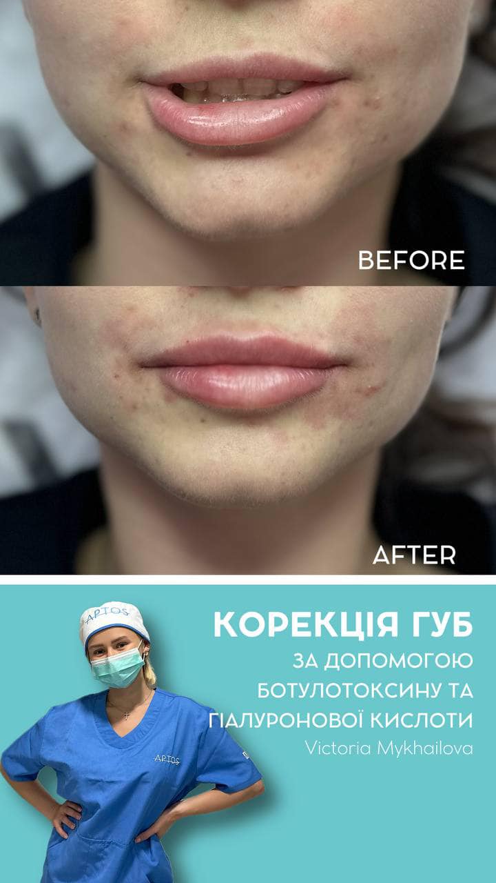 Вікторія, Пластичний Хірург - Фотографія 2