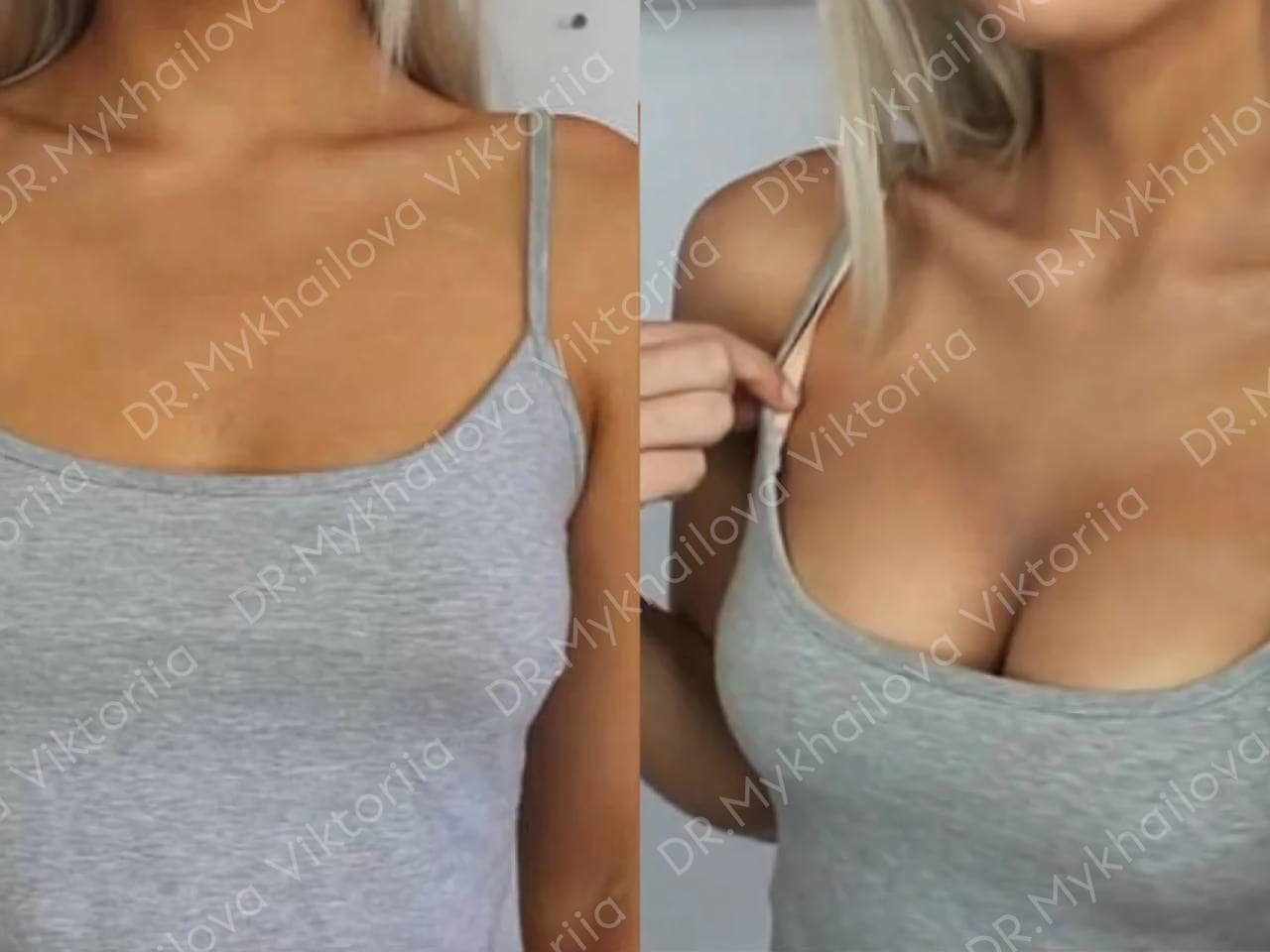 Вікторія, Пластичний Хірург - Фотографія 3