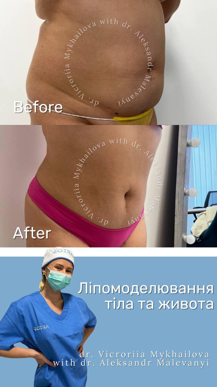 Вікторія, Пластичний Хірург - Фотографія 4
