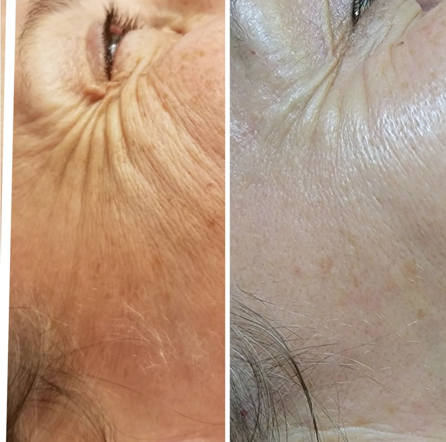 Ищете ключ к молодости и красоте вашей кожи. Откройте для себя Beauty от Галины - Фото 2