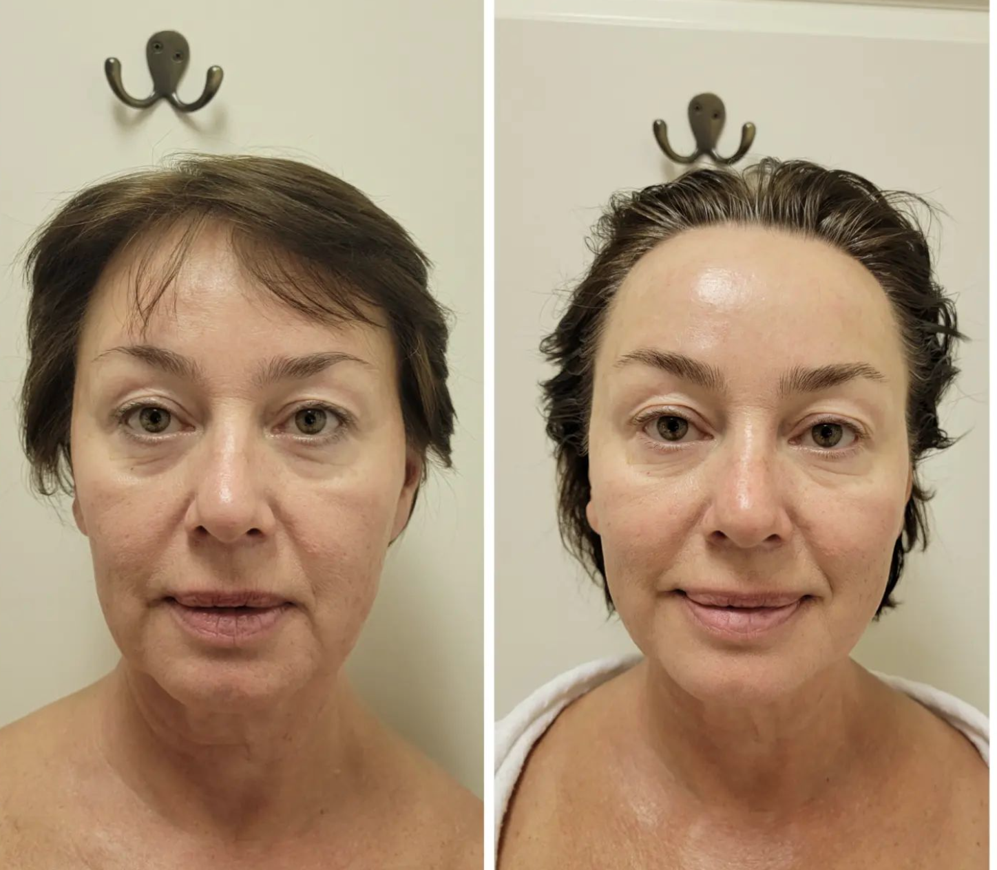 Ищете ключ к молодости и красоте вашей кожи. Откройте для себя Beauty от Галины - Фото 4