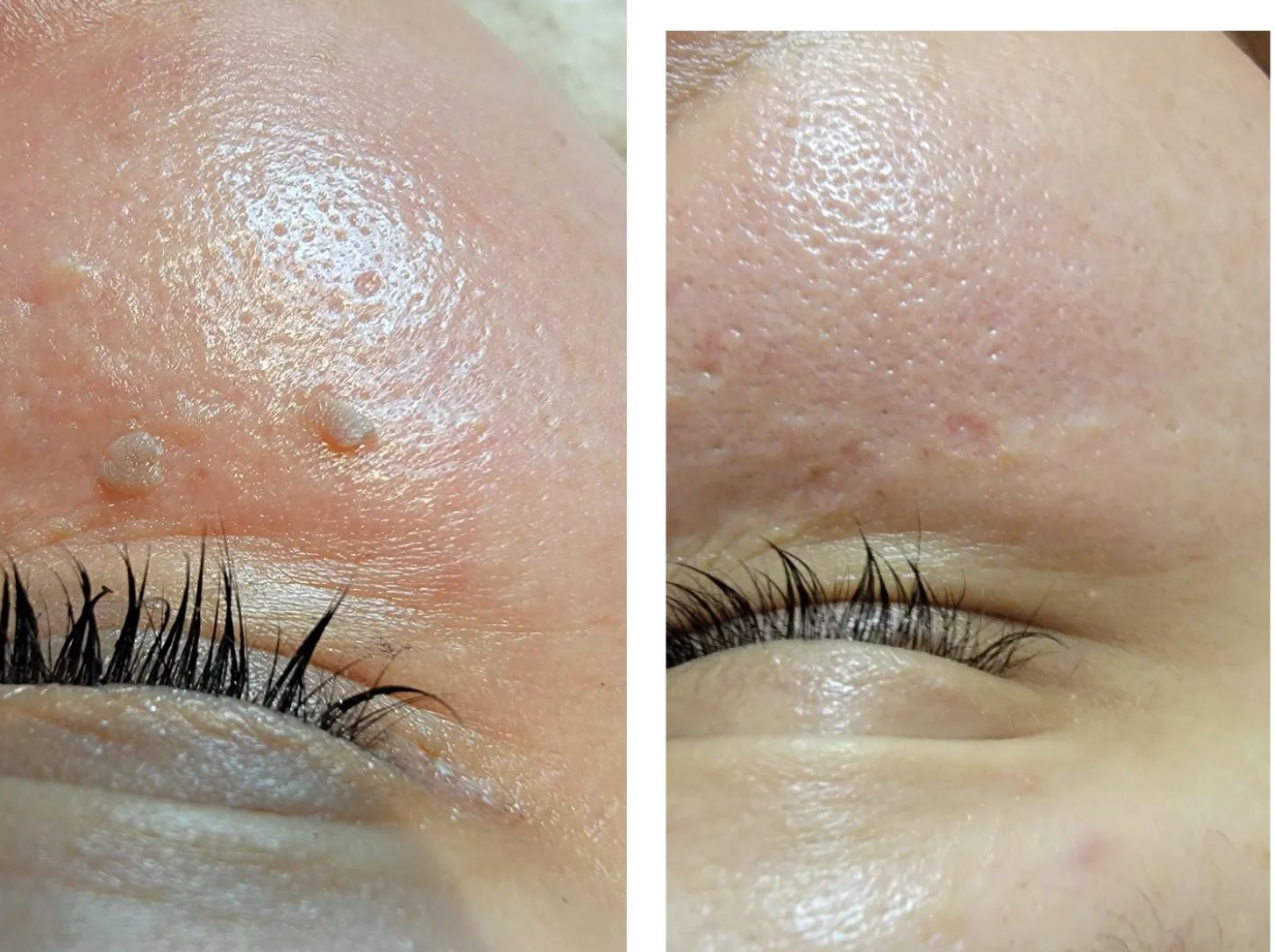 Ищете ключ к молодости и красоте вашей кожи. Откройте для себя Beauty от Галины - Фото 5