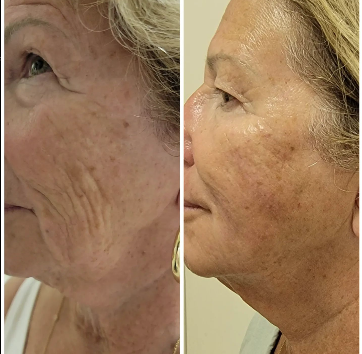 Ищете ключ к молодости и красоте вашей кожи. Откройте для себя Beauty от Галины - Фото 6