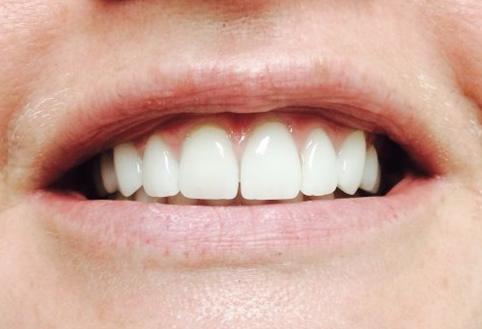 A2Z Dental Center - Фото 3