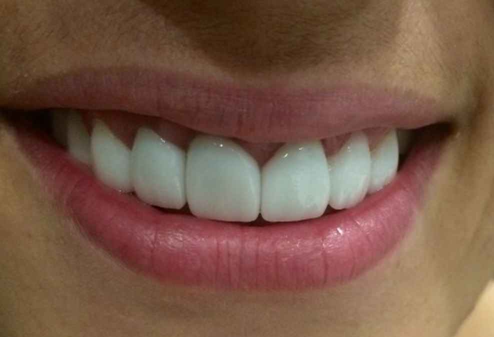 A2Z Dental Center - Фото 4