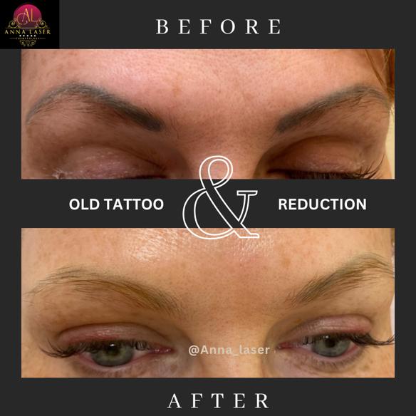 Anna Laser Cosmetology - салон лазерного удаления волос в Бруклине - Фото 3