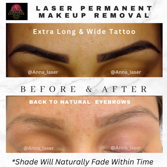 Anna Laser Cosmetology - салон лазерного удаления волос в Бруклине - Фото 4