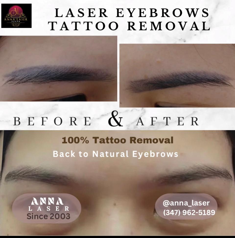 Anna Laser Cosmetology - салон лазерного удаления волос в Бруклине - Фото 6
