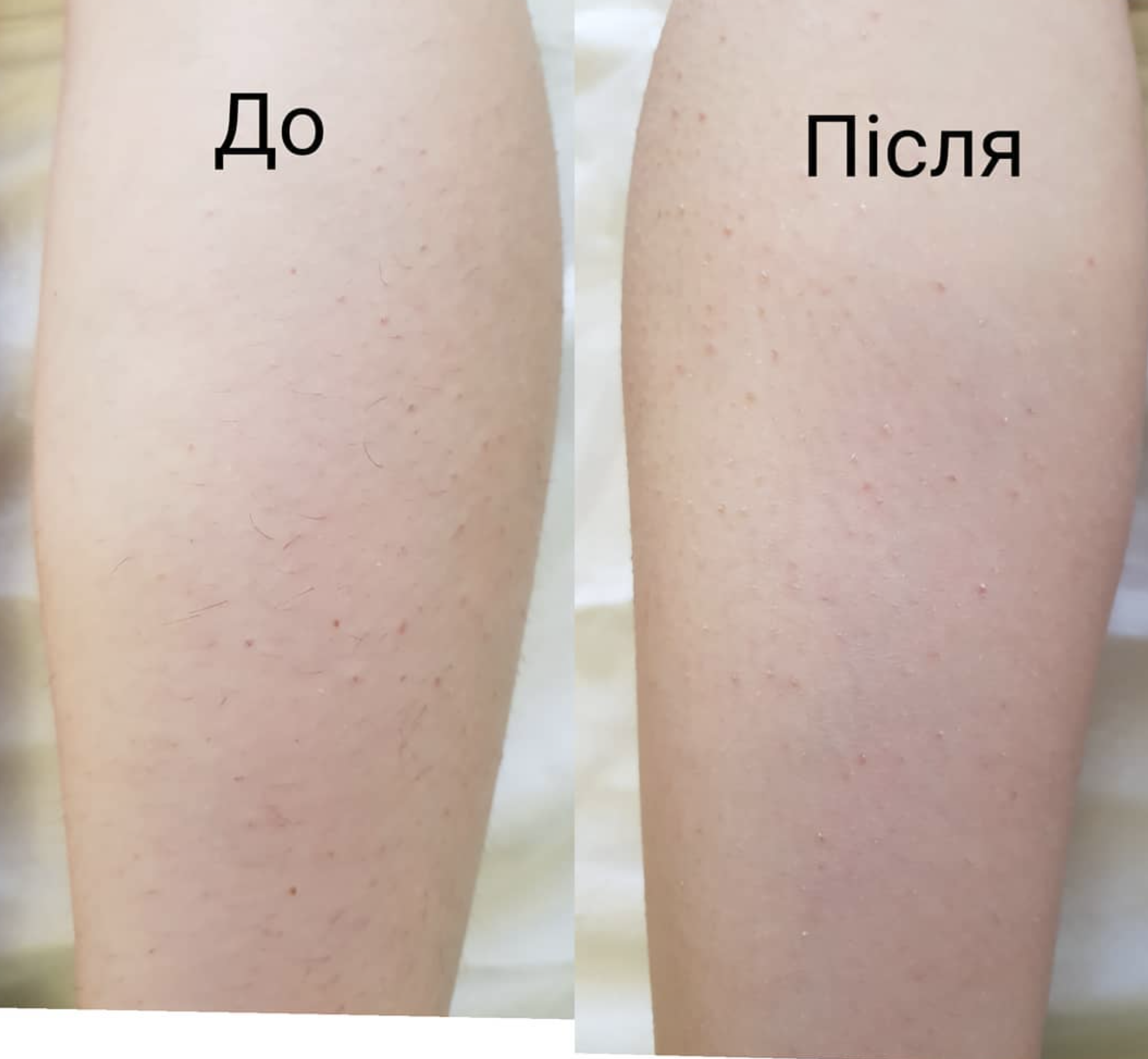 Іванна, Майстер Депіляції - Шугаринг - Фотографія 3