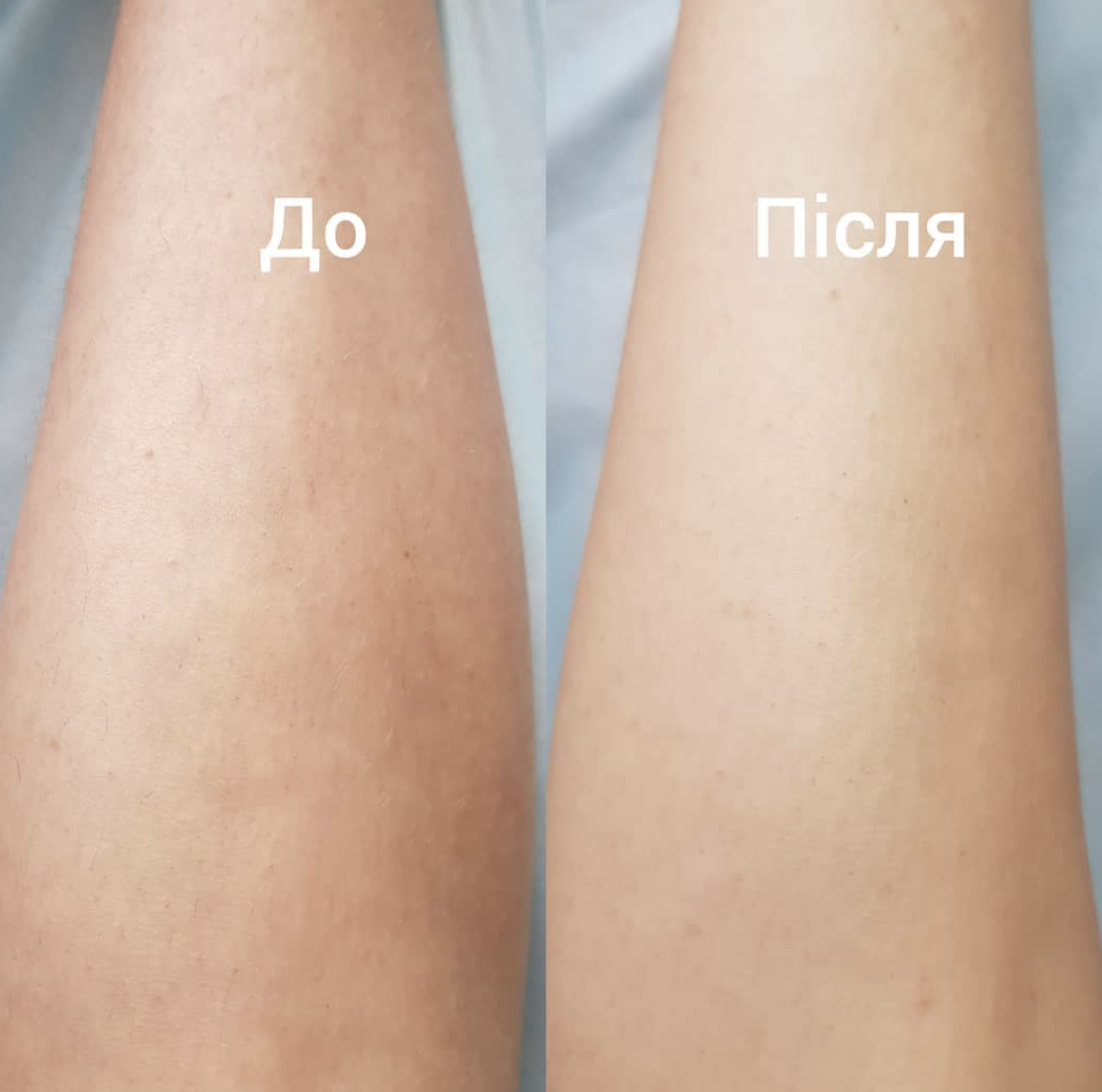 Іванна, Майстер Депіляції - Шугаринг - Фотографія 5
