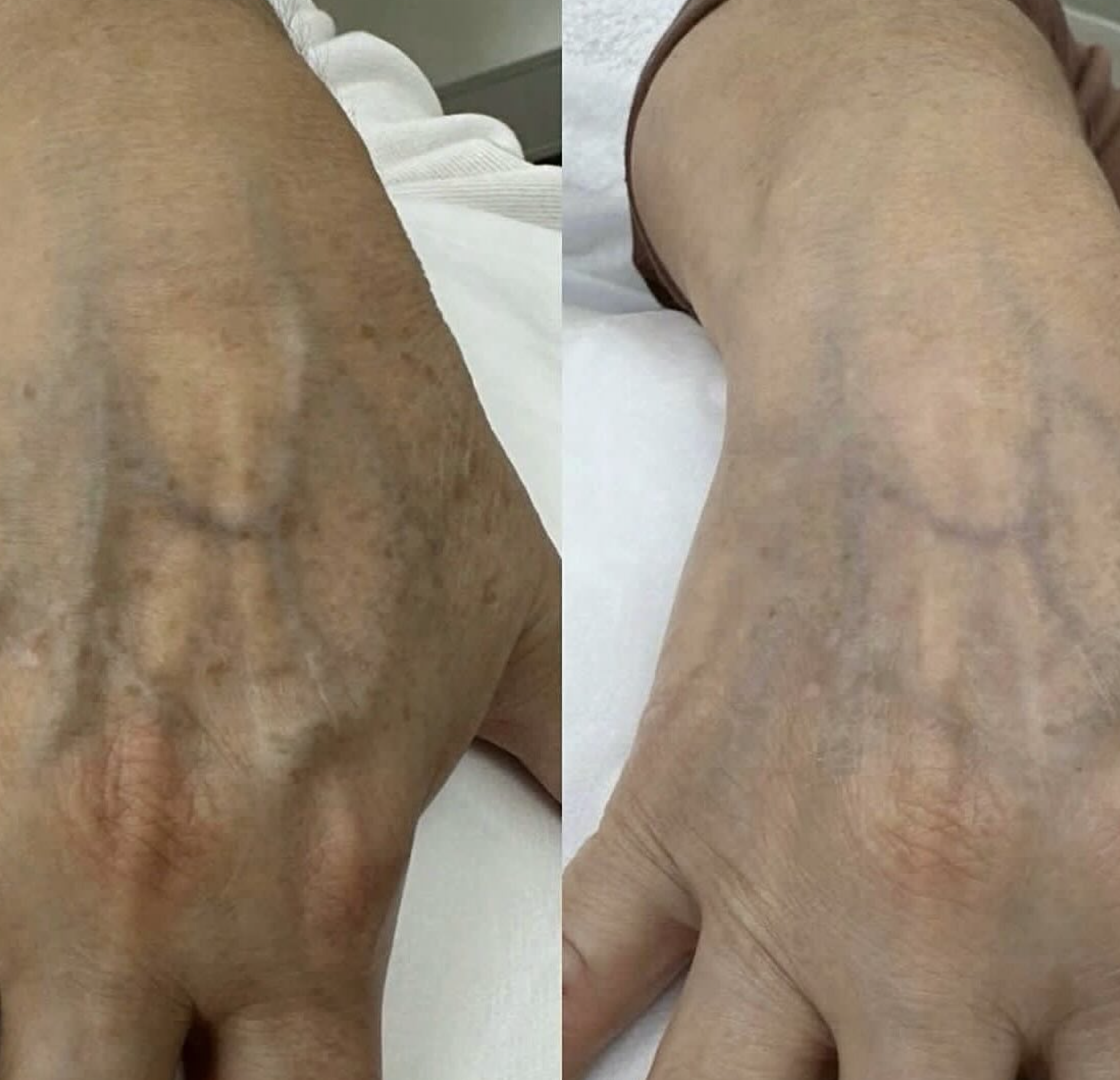 Silk Clinic - Laser Medicine - Фото 2