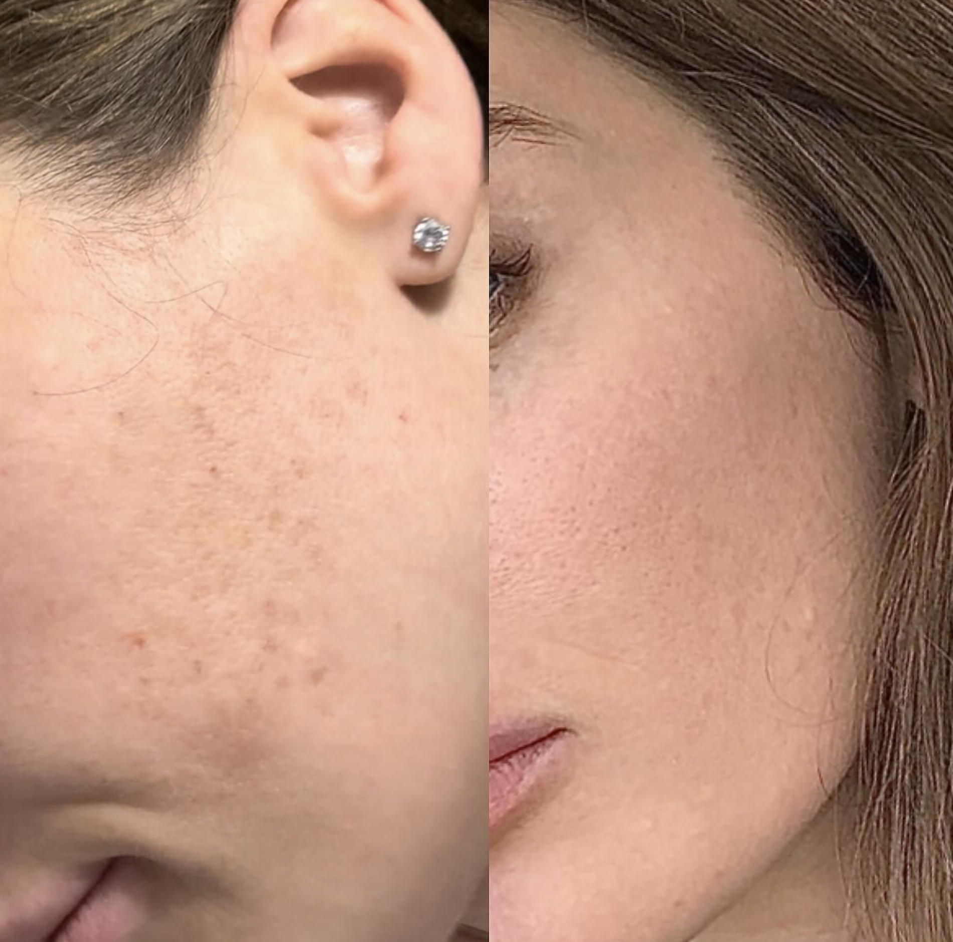 Silk Clinic - Laser Medicine - Фото 3