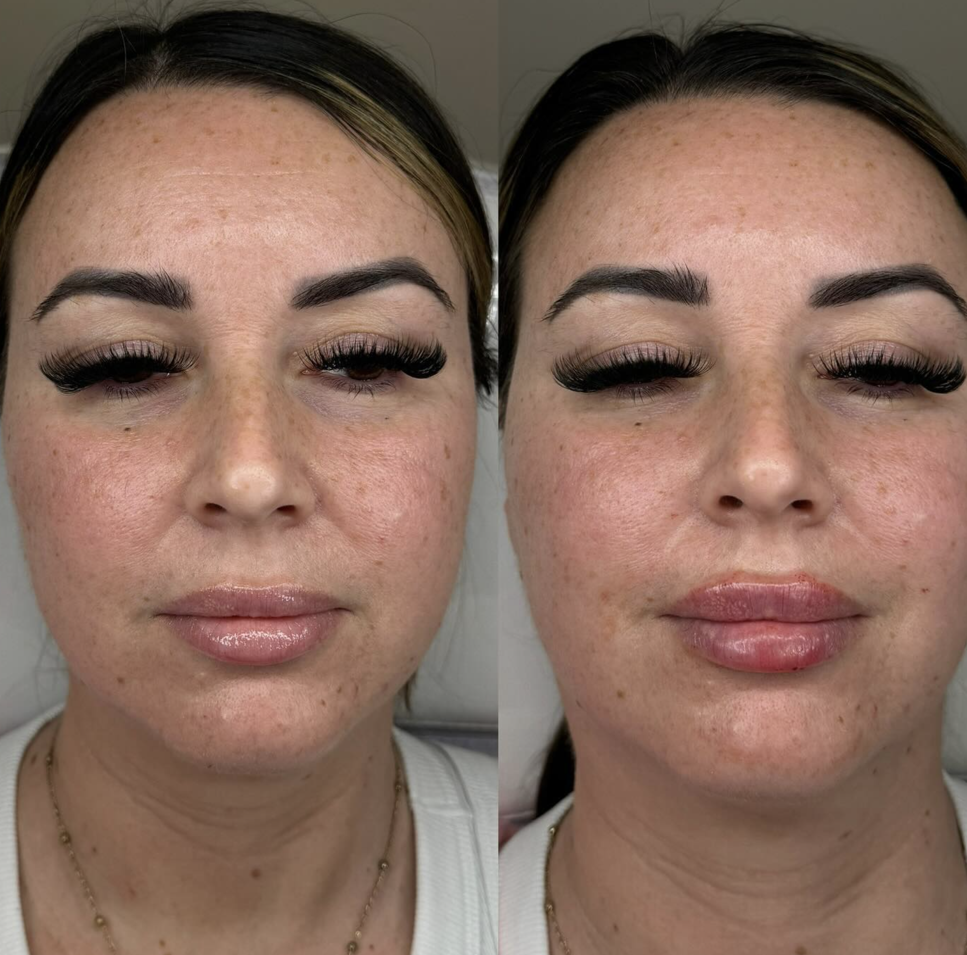 Silk Clinic - Laser Medicine - Фото 4