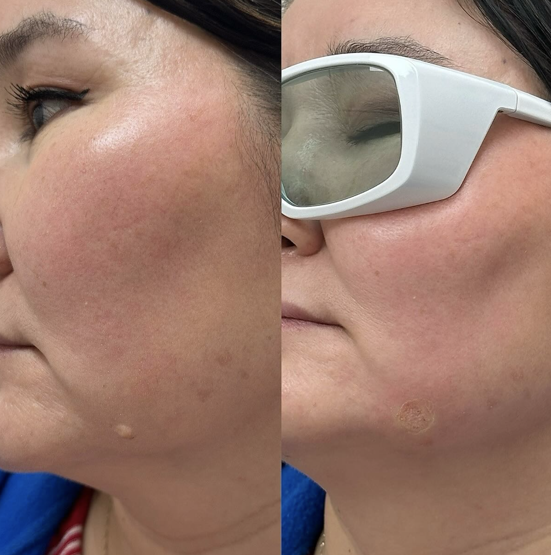 Silk Clinic - Laser Medicine - Фото 5