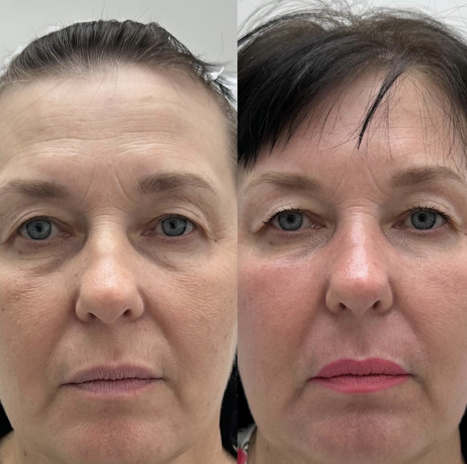 Silk Clinic - Laser Medicine - Фото 6