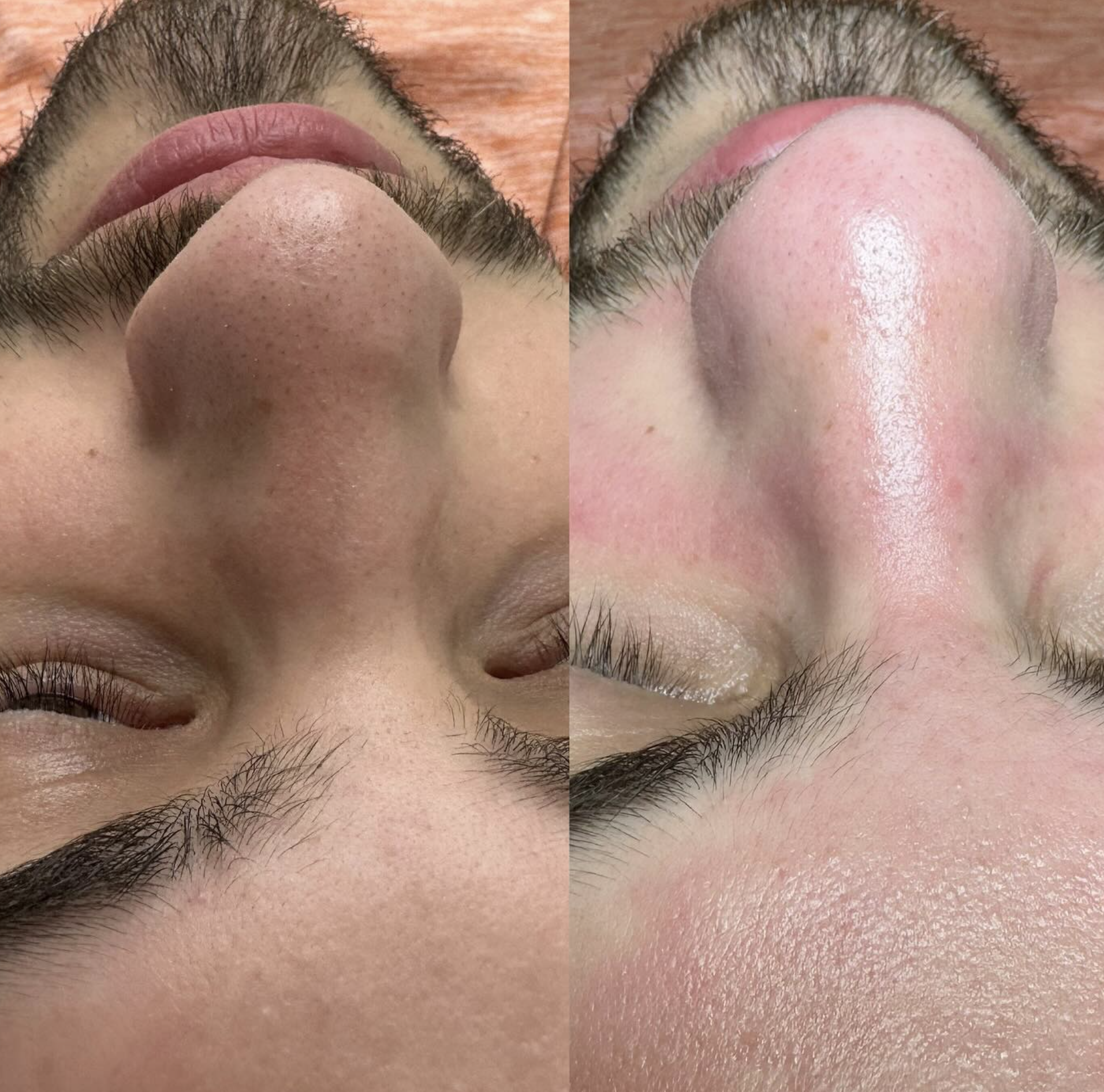 Silk Clinic - Laser Medicine - Фото 7