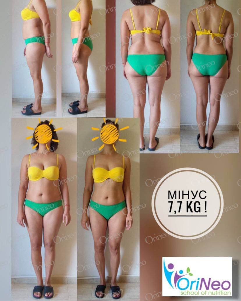 Ірина Куратор - Дієтолог - Фотографія 2