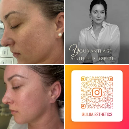 photo-kosmetolog-estetist-7