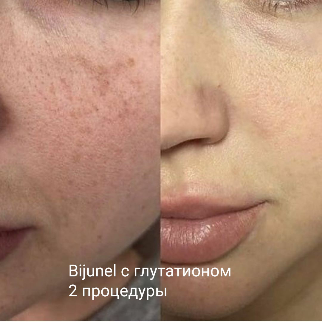 Услуги косметолога - Фото 2